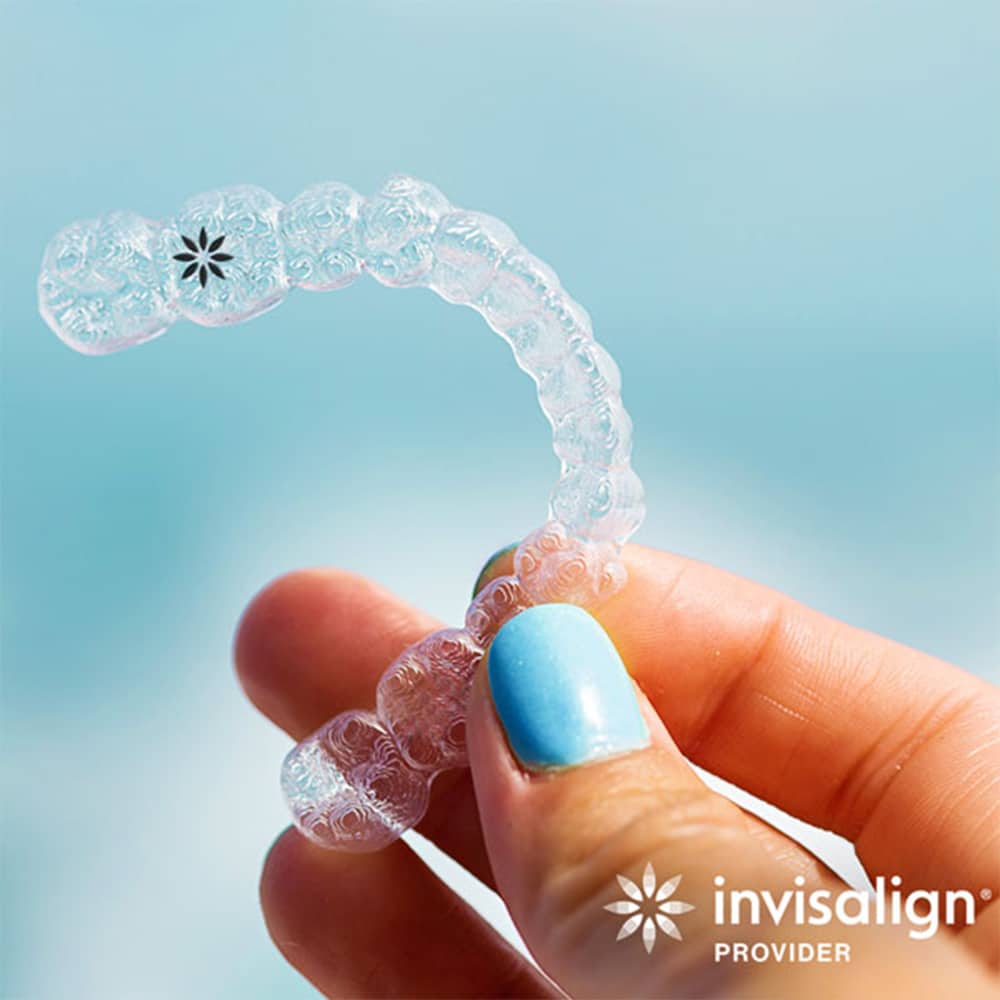 Invisalign Appliance